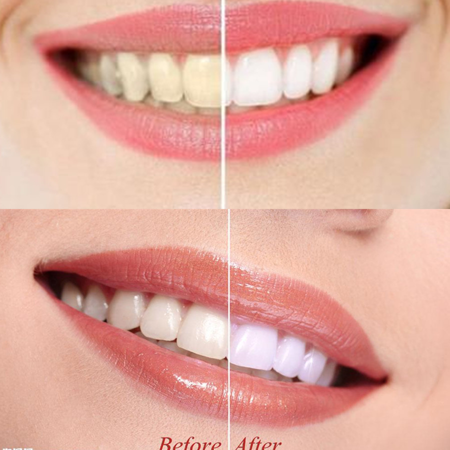 Bambusowy węgiel drzewny zęby  – Teeth Whitening Essence recenzja i cena