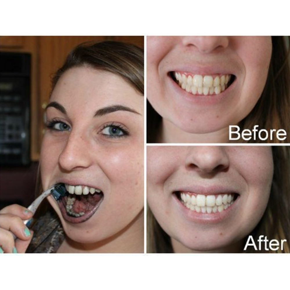 Bambusowy węgiel drzewny zęby  – Teeth Whitening Essence recenzja i cena