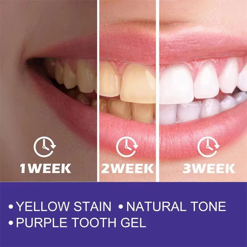 Pasta do zębów wybielająca, że – Teeth Whitening Korea recenzja i cena