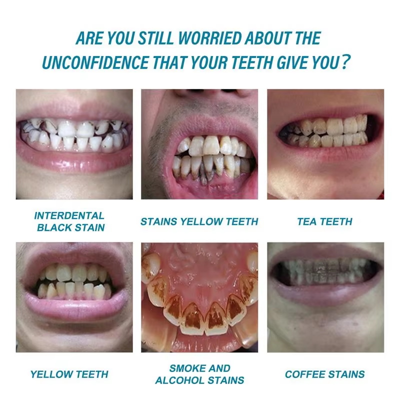 Esencja do wybielania zębów, u – Teeth Whitening Essence recenzja i cena