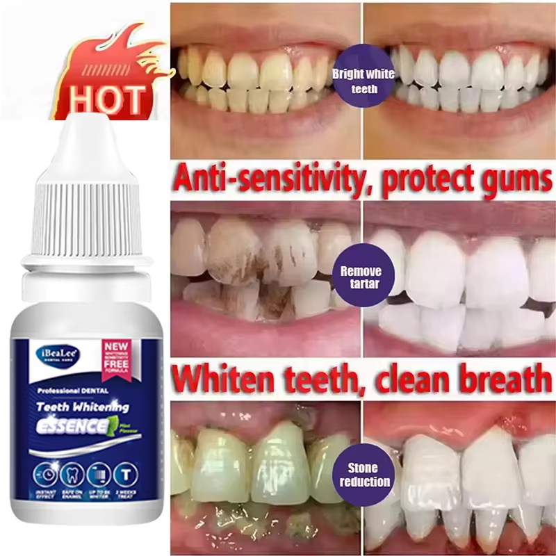 Esencja do wybielania zębów, u – Teeth Whitening Essence recenzja i cena