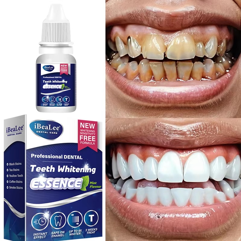 Esencja do wybielania zębów, u – Teeth Whitening Essence recenzja i cena