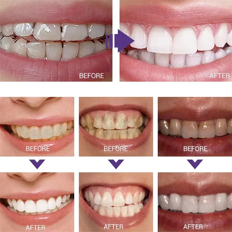 Pasta do czyszczenia i wybiela – Teeth Whitening Korea recenzja i cena