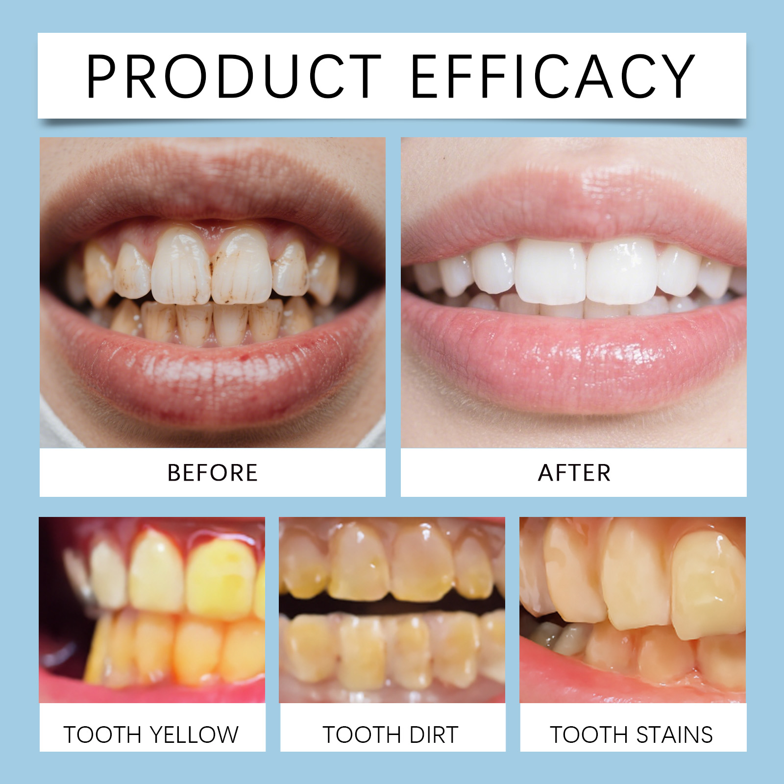 Feimuko 8ml Żelowy długopis do – Teeth Whitening Gels recenzja i cena