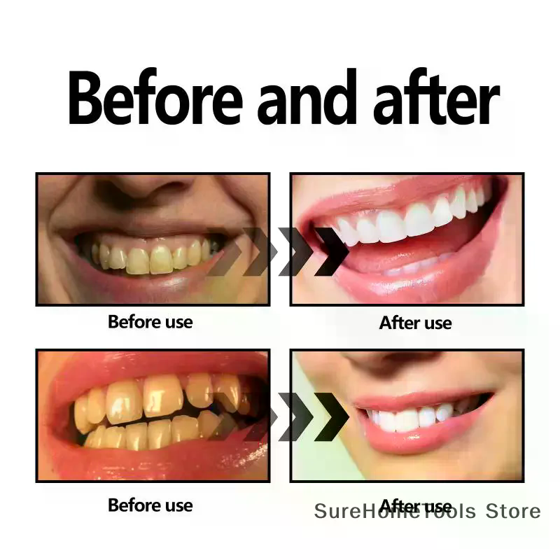 Proszek z węgla bambusowego do – Teeth Whitening Charcoal recenzja i cena