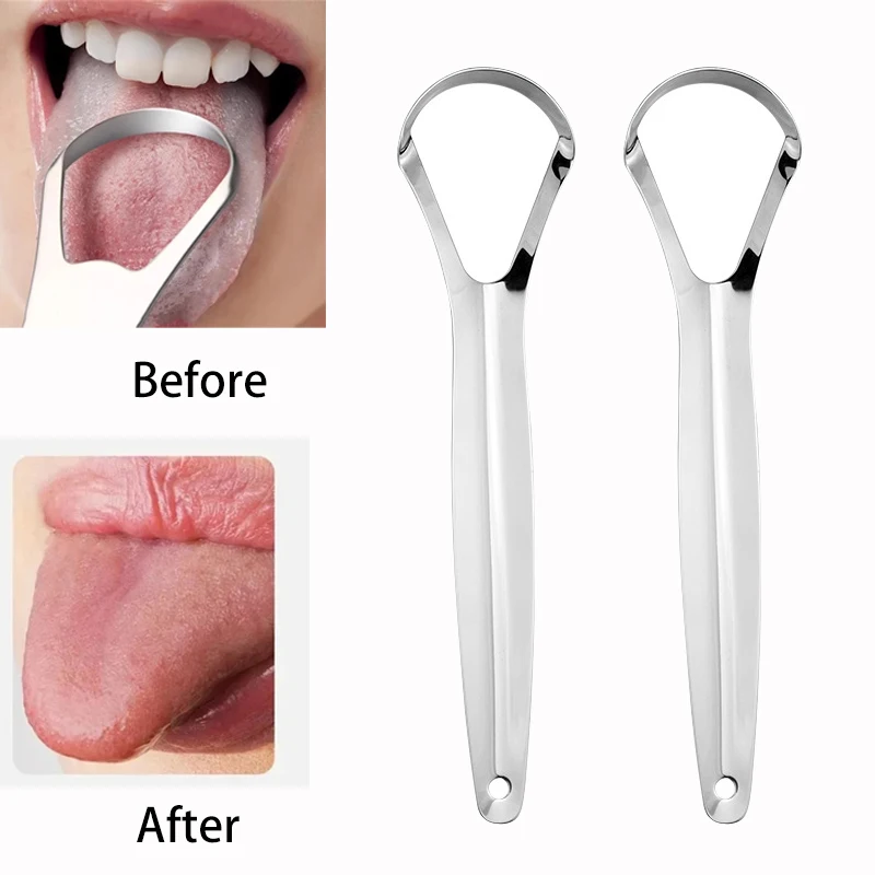 Halitosis powłoka języka skrob – Tongue Scraper Metal recenzja i cena