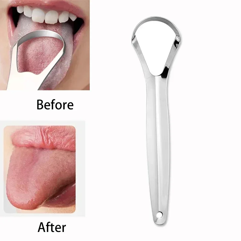 Halitoza, powłoka na języku, s – Tongue Scraper Metal recenzja i cena