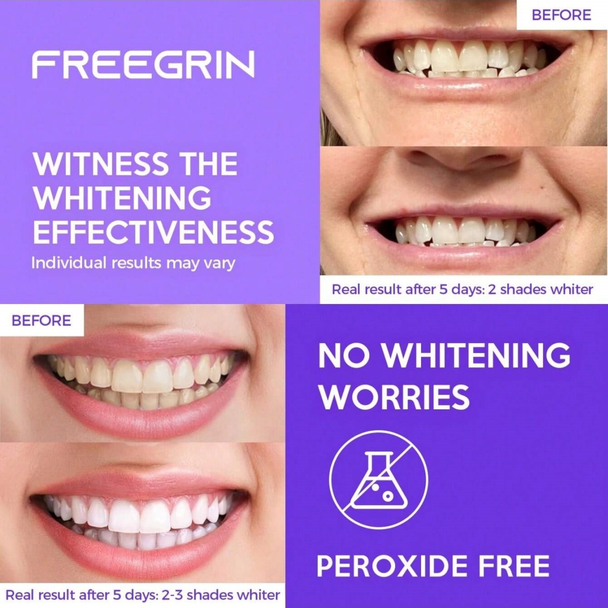 Naklejki wybielające do zębów  – Teeth Whitening From Home recenzja i cena
