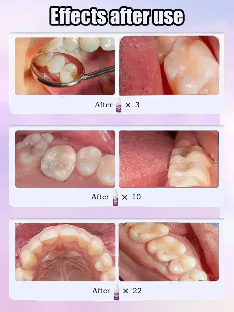 Pasta do czyszczenia zębów usu – Teeth Whitening Mouthwash recenzja i cena